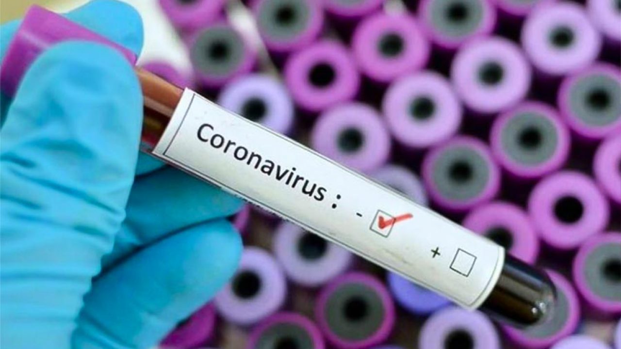 81 contagiados y un nuevo fallecido por Coronavirus reportó Rionegro