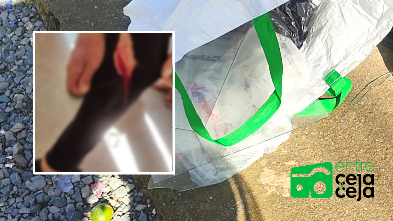 El Carmen: En una bolsa de basura botaron unos vidrios, una mujer se cortó la pantorrilla