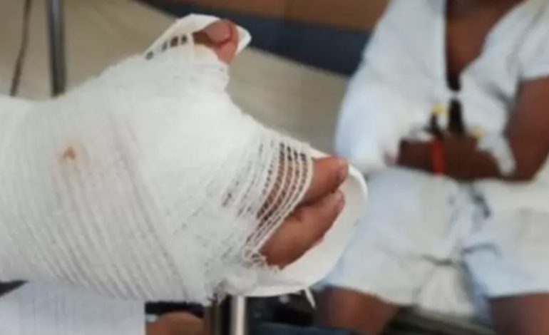 Hombre en El Retiro sufrió amputación de varios dedos tras quemarse con pólvora