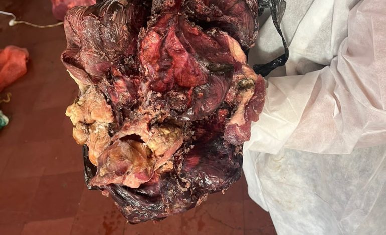 Incautan más de 100 kilos de carne en mal estado en El Carmen