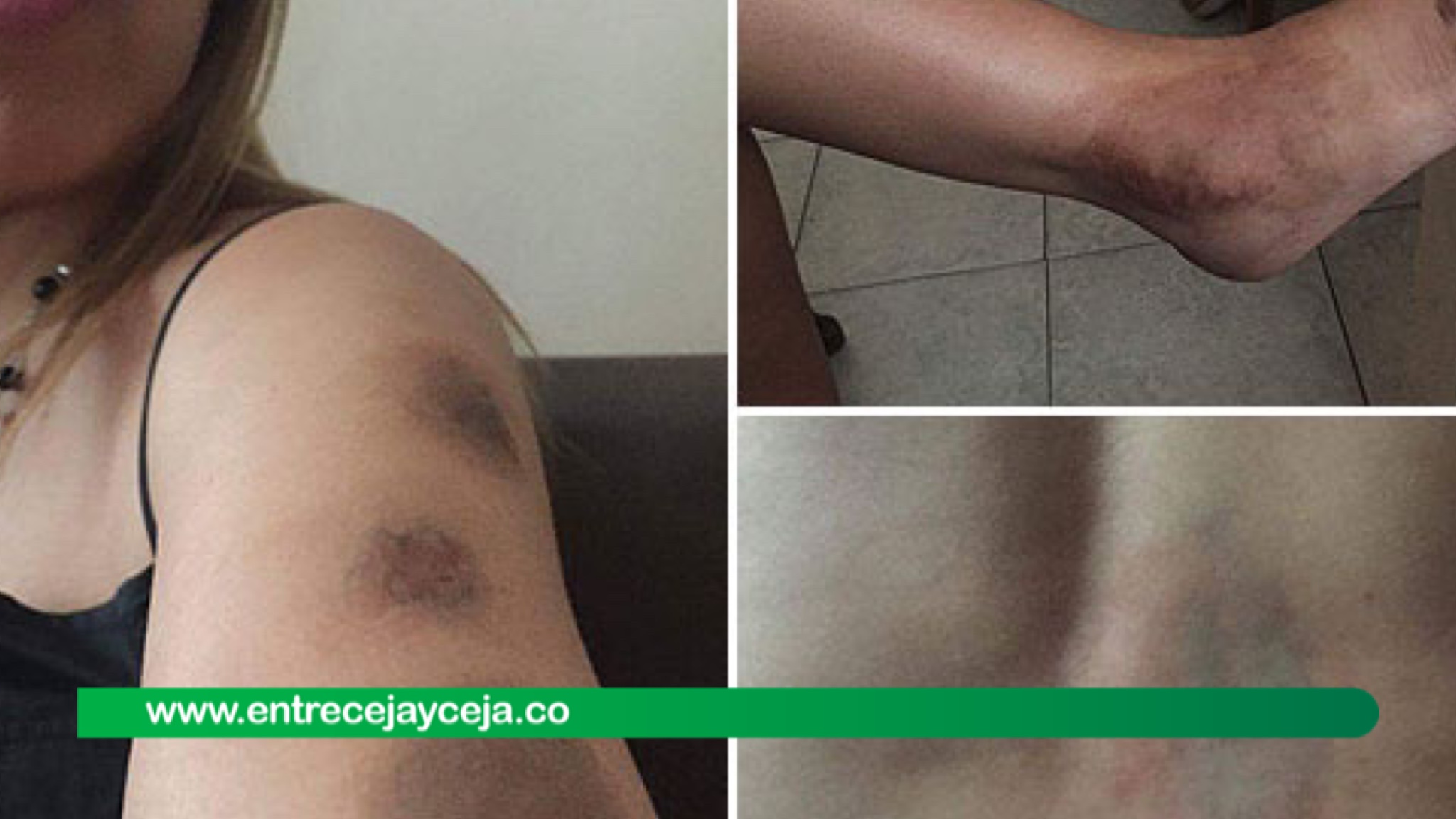 Un joven de 17 años le pegó a su propia madre; fue aprehendido por la Policía