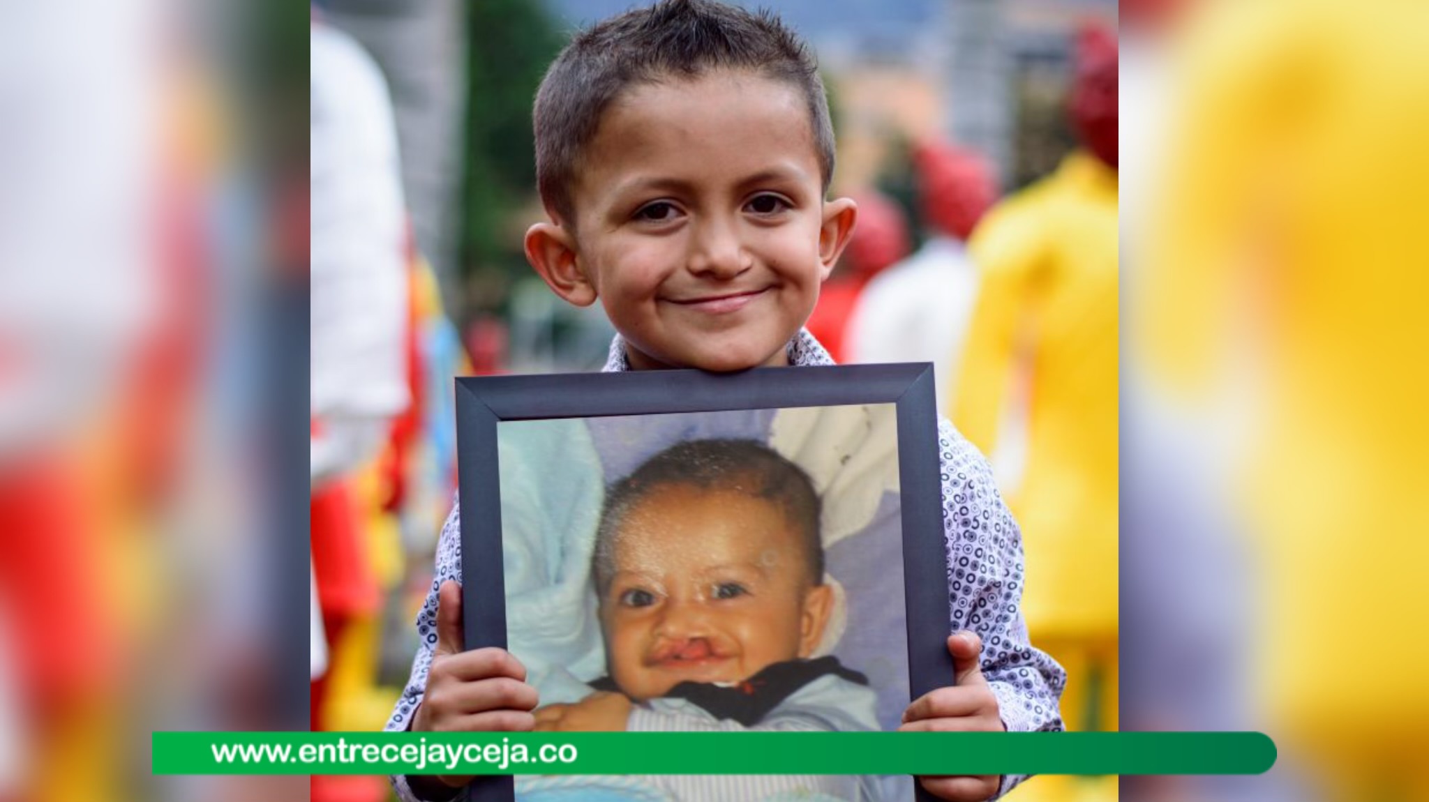 ¡Cirugías gratuitas a niños con malformaciones faciales!
