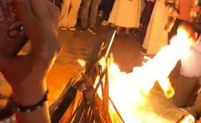 Granada: hombre resultó con graves quemaduras en su rostro durante celebración de la Vigilia Pascual