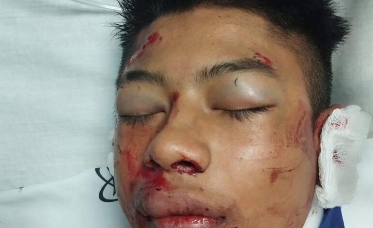 Joven fallecido en accidente en la vía Medellín - Bogotá, permanece sin identificar en Medicina Legal de La Ceja