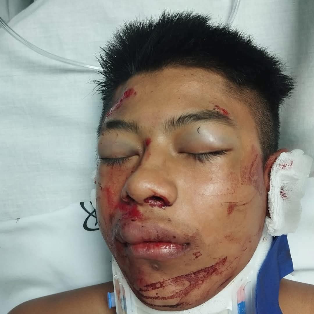 Joven fallecido en accidente en la vía Medellín - Bogotá, permanece sin identificar en Medicina Legal de La Ceja