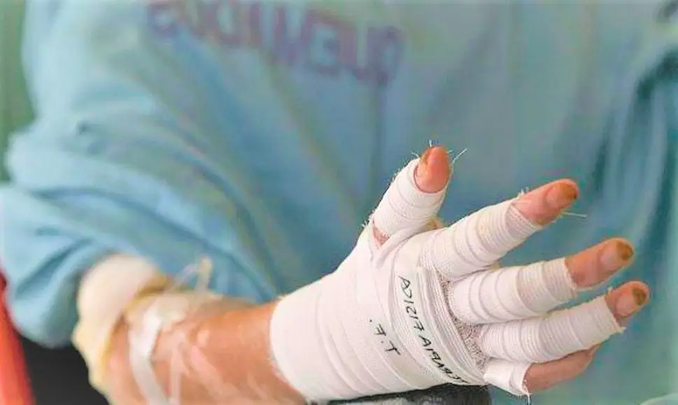 Consecuencias de la alborada en Antioquia: 11 lesionados por pólvora